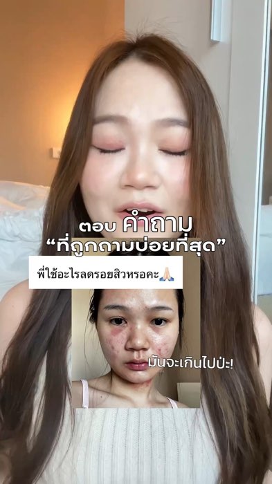 ใช้ตามพสคนสวยๆค่ะ ิิ #smoote #รอยสิว #รอยดำ #รอยแดง #สิว #acne